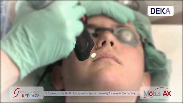 Motus AX Depilación Láser - Facial смотреть онлайн