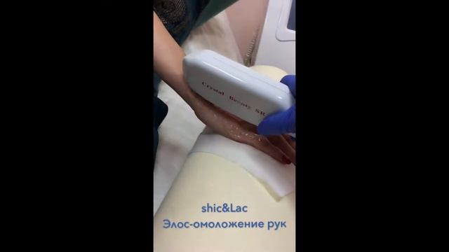 Элос-омоложение Рук