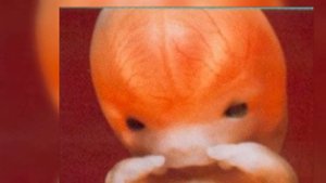 Развитие зародыша человека / Development of the human embryo