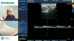 Мастер-класс на аппарате S8Exp. Лектор: Заболотская Н.В.