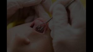 Кому нужен логомассаж?