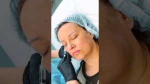 Демонстрация процедуры БИОРЕВИТАЛИЗАЦИЯ «ПЯТЬ ЗВЁЗД»