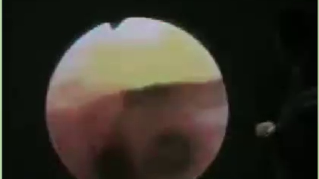 Рак излечим
