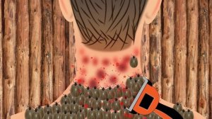 Asmr removal of lice tick from back neck |treatment |stop motion| 2D Animation