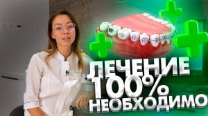 Кому 100% показано ортодонтическое лечение?