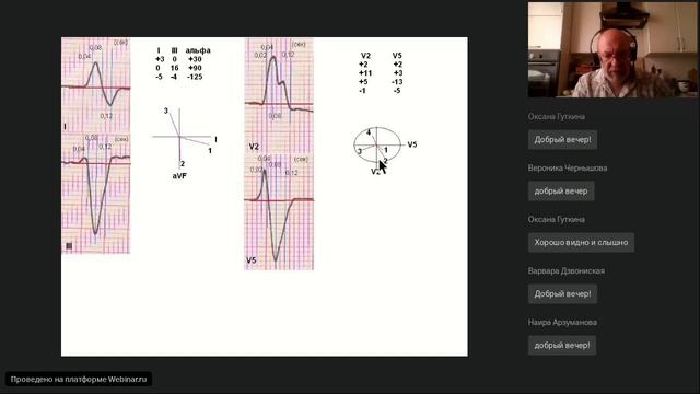 Векторный анализ QRS комплекса