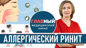 Аллергический РИНИТ: симптомы и лечение. Как избавиться от аллергического ринита навсегда