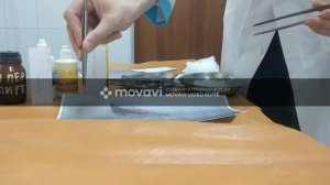 Первичная хирургическая обработка раны