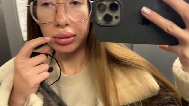 Я УДАЛИЛА ГУБЫ! | отек Квинке?