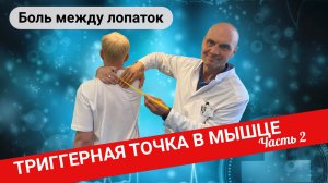 БОЛЬ МЕЖДУ ЛОПАТКАМИ. Триггерные точки в мышце. Лечение (Часть 2)