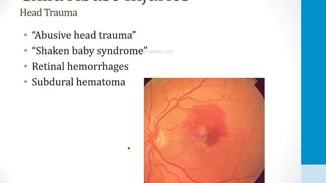 Психиатрия USMLE - 2. Патология - 1.Жестокое обращение с детьми и безнадзорность (Boards and Beyond)