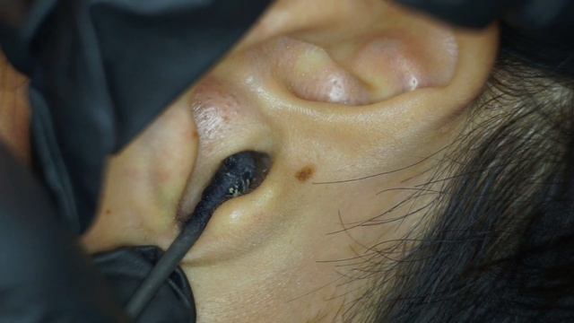 Удаление ушной серы соответствует стандарту ASMR Black q-tip (ватный тампон)20211115 смотреть онлайн