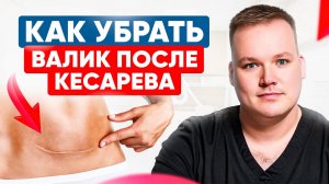 Самая СТРАШНАЯ ОШИБКА! Как восстановиться после кесарева?