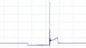 Ford F150 Misfire Case Study