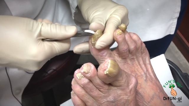 Not Able to Cut her Nails for 2 Years. Full Episode! смотреть онлайн