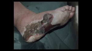 Объект 12 - ЖИДКАЯ БОЛЬ (The Backrooms)