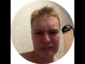 Последствия травмы колена