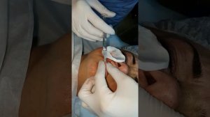 Мастер-класс по контурной пластике. Постановка филлеров. Убираем кисет ..