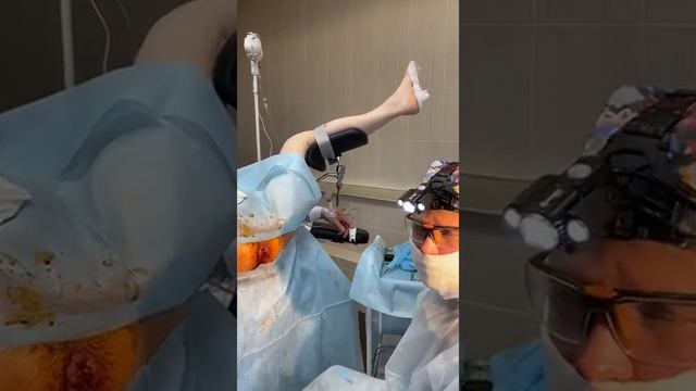 удаление геморроидальных узлов лазером смотреть онлайн