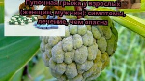 Пупочная грыжа у взрослых (женщин, мужчин): симптомы, лечение, чем опасна