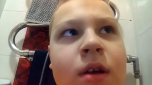 Как мне отрезали уздечку.