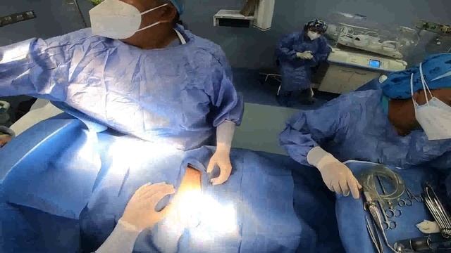 Cesarean delivery / c-section. смотреть онлайн