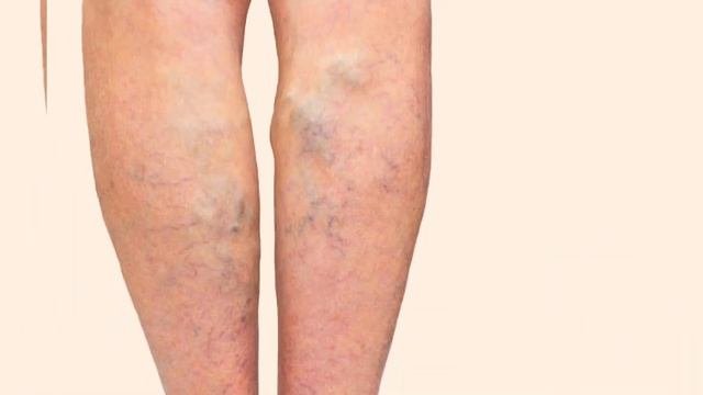 От каких болезней помогает денежное дерево? #денежноедерево