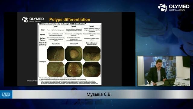 Интерпретация колоноскопических находок эндоскопистом и патологом смотреть онлайн
