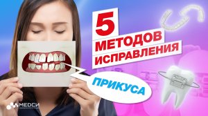 5 методов исправления прикуса