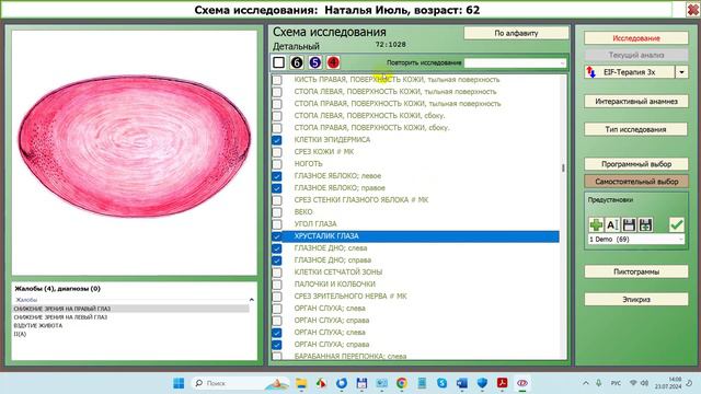 2024-07-23_142300-Дианел®-2.1Новый пациент, Анамнез, Физиогномика, Положение пациента, Тестирование