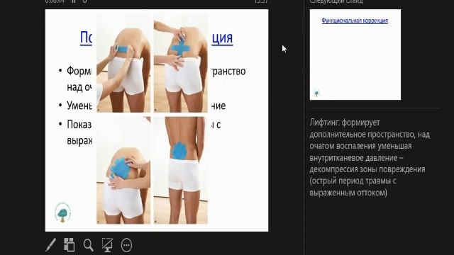 Кинезиотейпинг