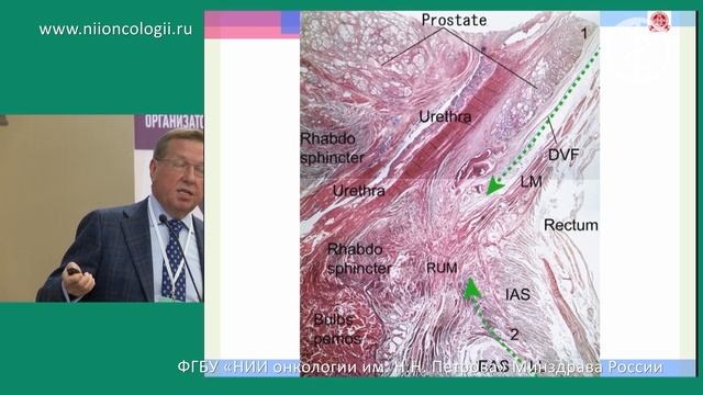Анатомия прямой кишки как основа концепции ТМЕ