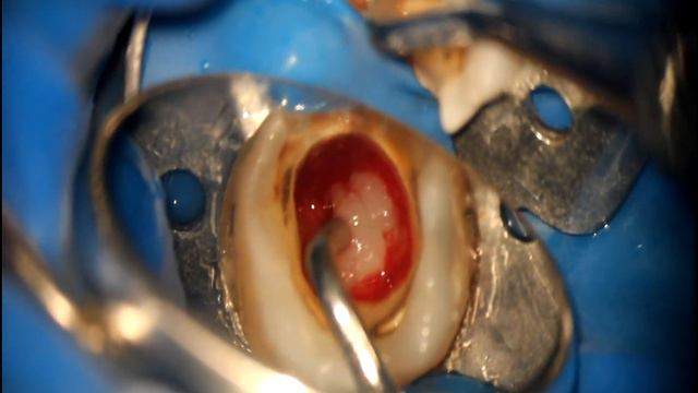 кастрація смотреть онлайн