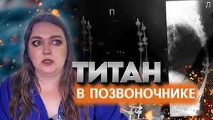 Жизнь с титановой конструкцией в позвоночнике. Моя история психотравмы