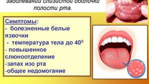 Стоматит. Что делать? Психосоматика