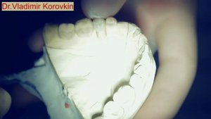 Полировка зуба на модели  Не урони коронку на пол!!!