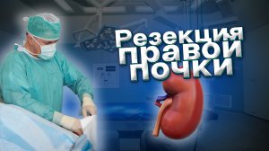 Резекция почки