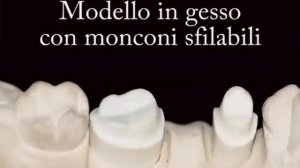 3D принтер зуботехнический