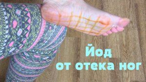 Как избавиться от ОТЕКА НОГ с помощью йода.