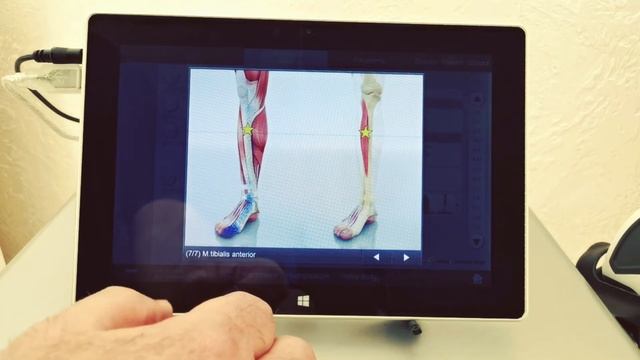 Обзор интерфейса аппаратов ударно-волновой терапии Storz Medical: протоколы лечения смотреть онлайн