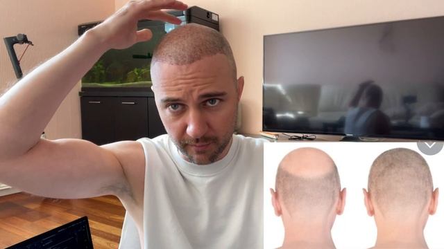 Личное мнение: Почему мне нравится система волос Hair System / Красавчик