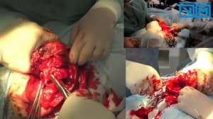 Удаление конечности у собаки