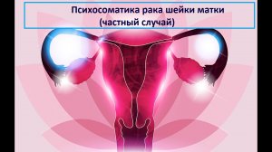 Психосоматика рака шейки матки (частный случай)