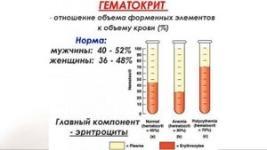 Гематокрит - что это такое