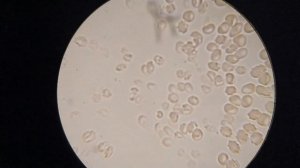 Влияние РОЗМАРИНА на кровь человека