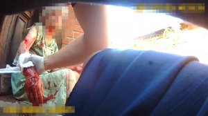 Полицейские застрелили собаку и спасли покусанную женщину