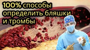 Выяви БЛЯШКИ и ТРОМБЫ в своём организме, Профилактика и лечение атеросклероза, узи, Д Димер