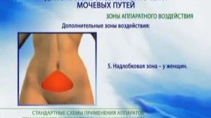 Методика ДЭНС при заболеваниях почек и мочевыводящих путей