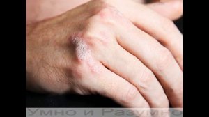 Грецкие орехи, вот в чём их польза и вред