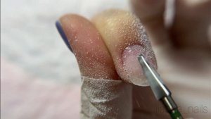 Укрепление акригелем/восстановление ногтей/форма четкий квадрат